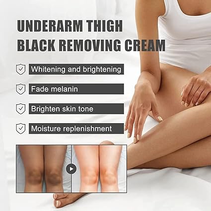 🔥Dark Spot Eraser Cream